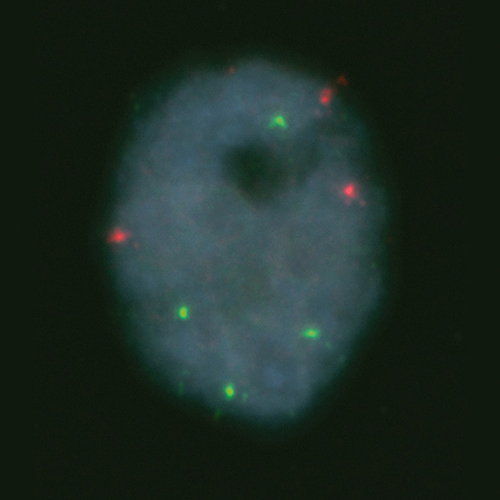 15q22 / 6q21 Foto do produto