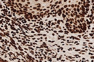 6.25mL DNA Positive Cont Probe Foto do produto