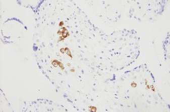 5.5 ml Bond CMV Probe Foto do produto