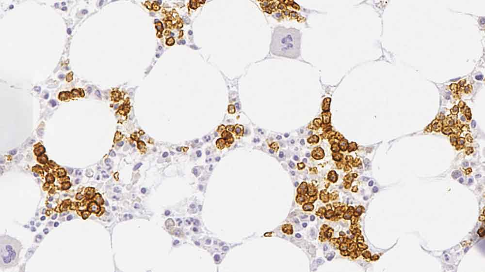 CD71 product photo Front View S