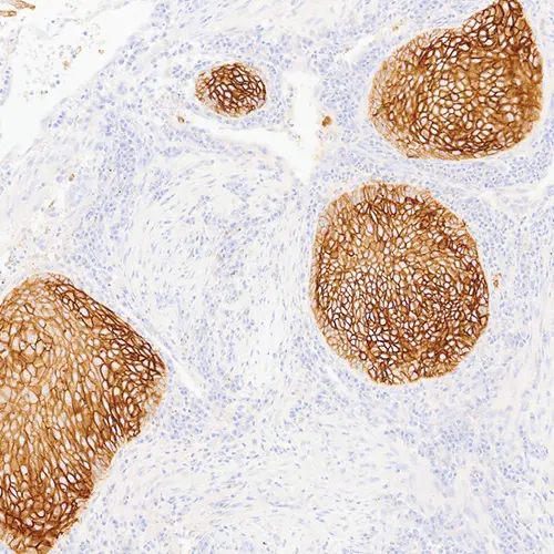 Desmoglein 3 product photo