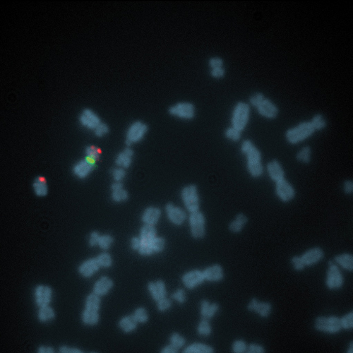 RUO - SHOX (Xp22) / SE X (DXZ1) product photo Front View S