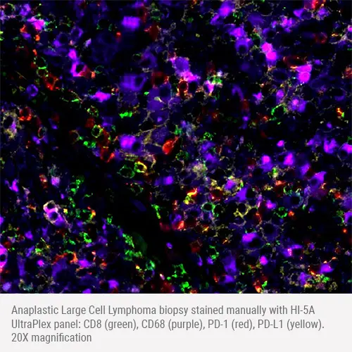 HI-5A mxIF - CD8/CD68/PD-1/PD-L1 product photo