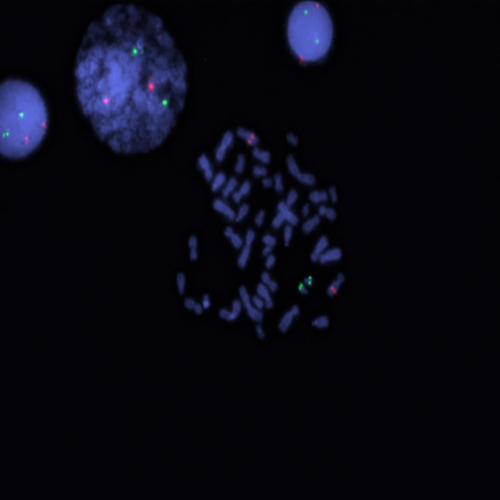 RUO - RUNX1 (21q22) / RUNX1T1 (8q21) photo produit Front View S