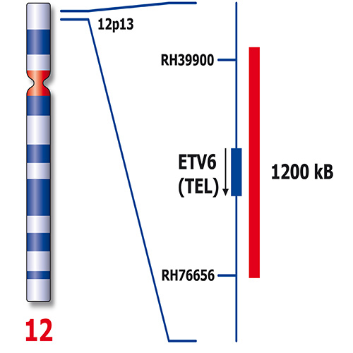 RUO - ETV6 / RUNX1 (12q13 / 21q22) photo produit Back View S