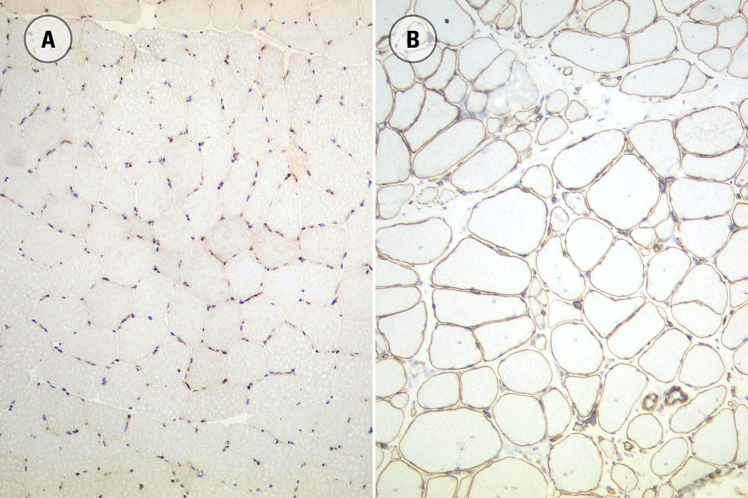 Utrophin photo produit