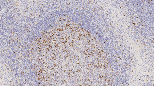 CTLA-4 photo produit