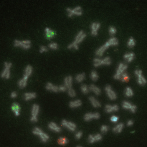 RUO - PML / RARA (15q24/17q21) photo produit Front View S