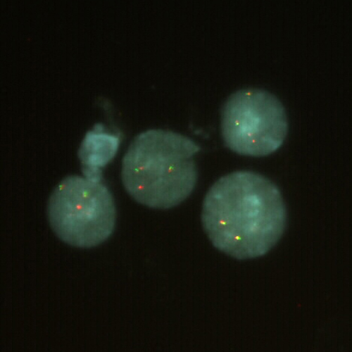 RUO - MAFB (20q12) / IGH (14q32) photo produit