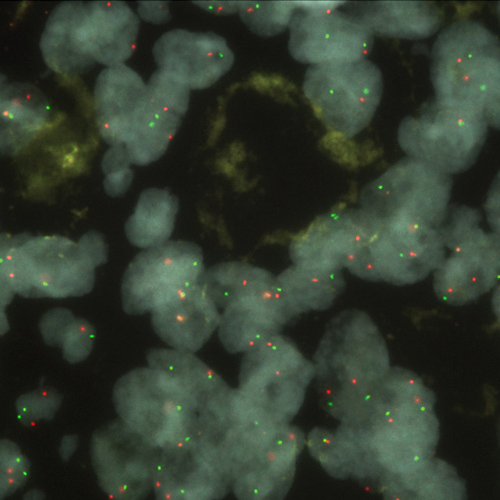 RUO - CDKN2A / 9q21 (tissue)(9p21) photo produit Front View S