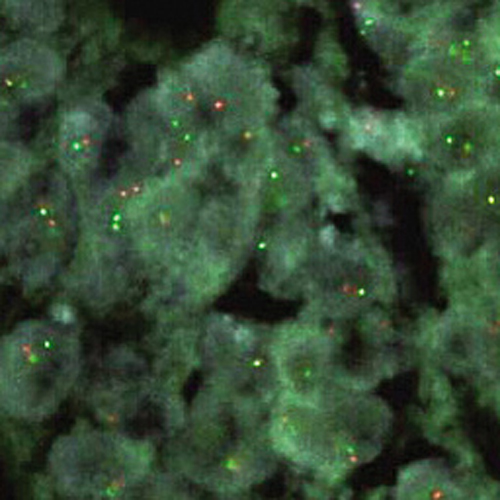 RUO - ERCC1 / ZNF443 photo produit Front View S