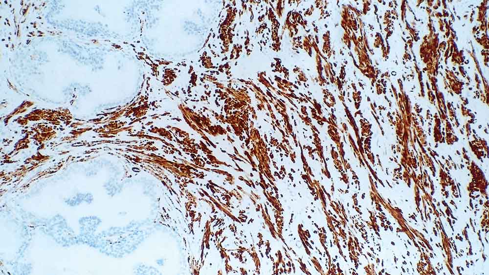 Myosin Heavy Chain Antibodies photo produit
