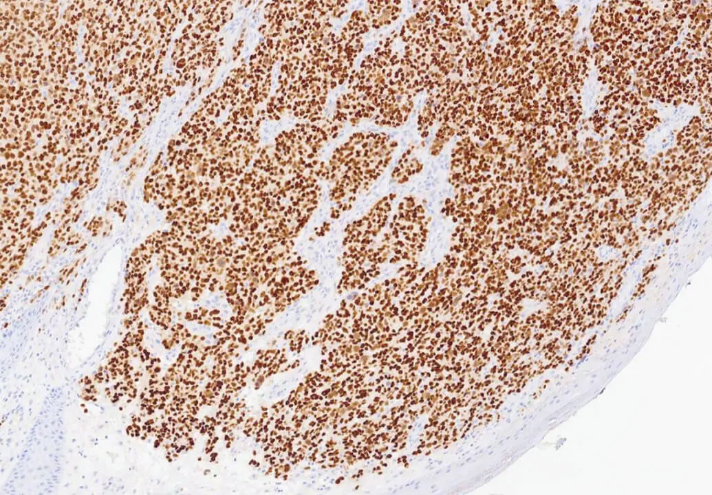 SOX10 - IHC Primary Antibodies photo produit Side View S