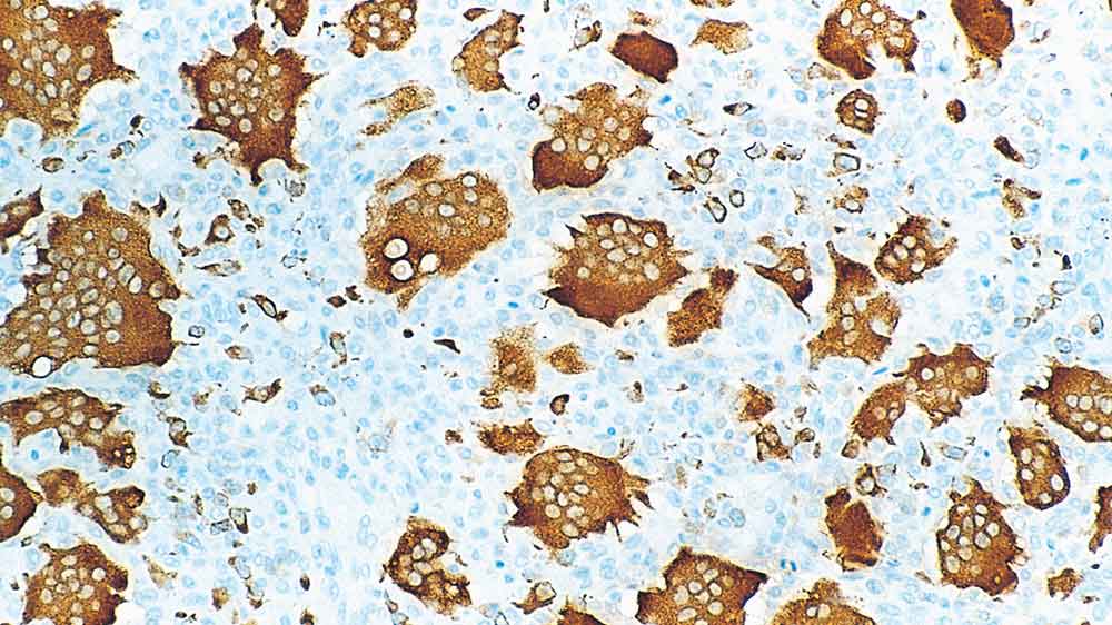 Tartrate-Resistant Acid Phosphatase (TRAP) photo produit Front View S