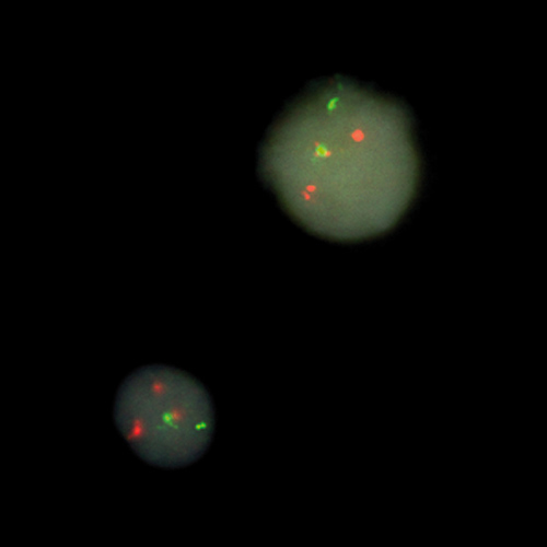 BCR/ABL1 t(9;22) DC, S-Fusion, ES Produktfoto