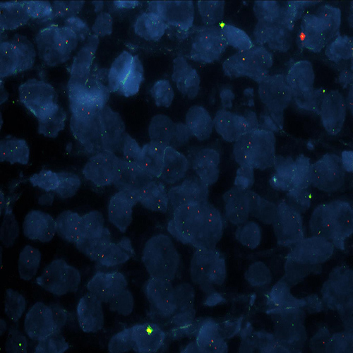 IVD ALK Break Produktfoto Front View S