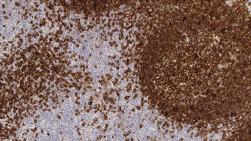 1ml NCL-L-CD19-163 Produktfoto