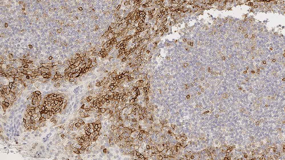 CD99 Produktfoto Front View S