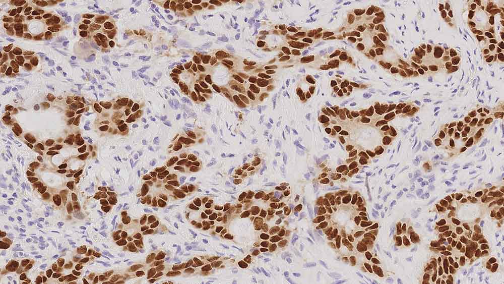 7ml CDX2 (EP25) Bond RTU Primary Produktfoto