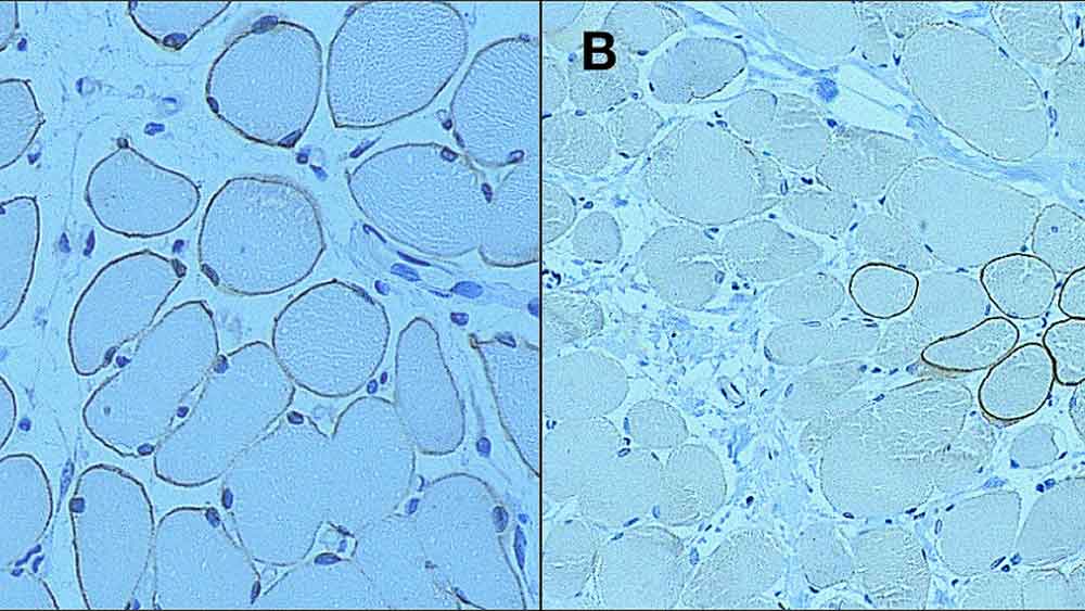 Dystrophin Antibodies Produktfoto