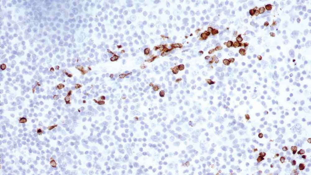 1ml NCL-L-GRAN-B Produktfoto