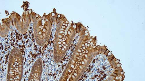 Immunoglobulin A Produktfoto