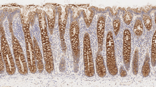 7mL Muc-4 Glycoprotein (EPR9308) BondRTU Produktfoto