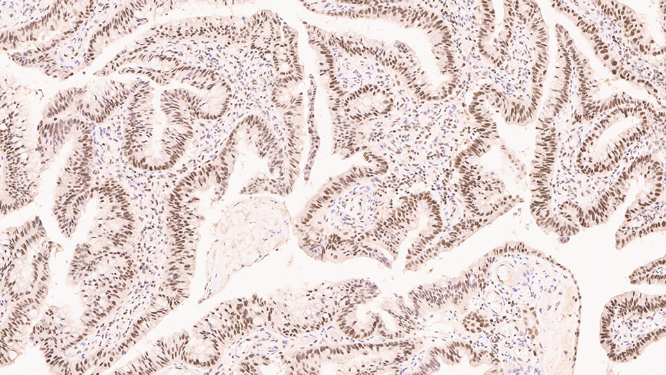 Mismatch Repair Protein (PMS2) Produktfoto
