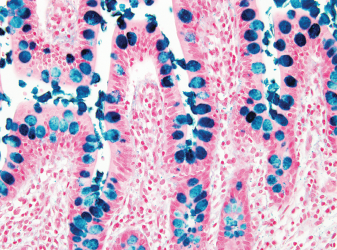 Alcian Blue Special Stain Kit Produktfoto Front View S