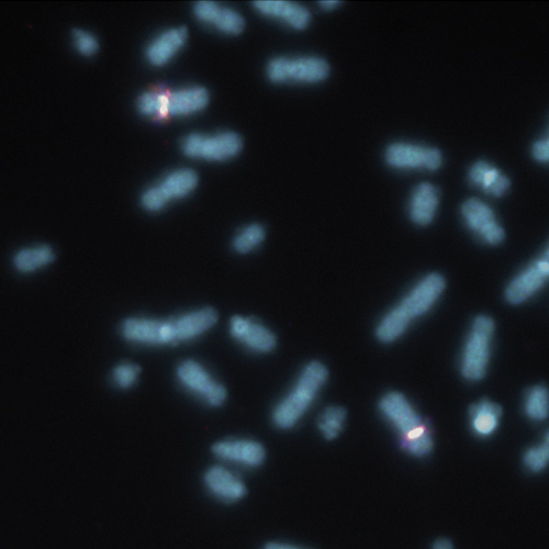 IVD FIP1L1/CHIC2 /PDGFRA Triple-Color product photo