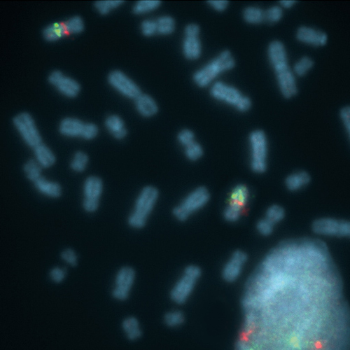 IVD ELN/7q22 product photo Front View S