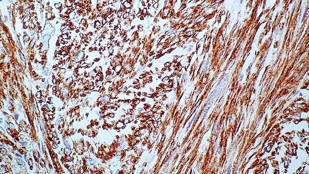 Muscle Specific Actin product photo