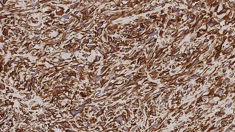 Vimentin product photo