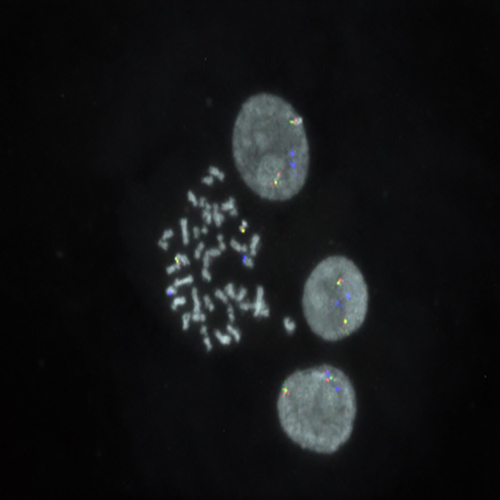 IVD CRLF2/IGH photo produit Front View S