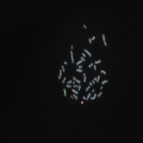 IVD SE X/SE Y/SE 18 photo produit