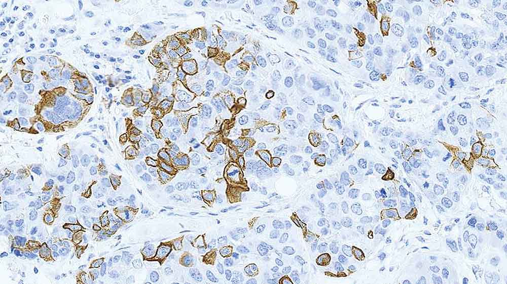 Cytokeratin 14 photo produit