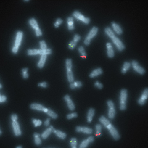 TP53 (17p13) / ATM (11q22) photo produit