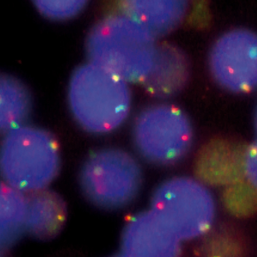 MALT1 (18q21) Break photo produit