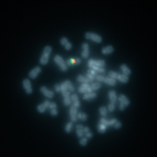 X-Inactivation XIST (Xq13) / SE X 10T photo produit