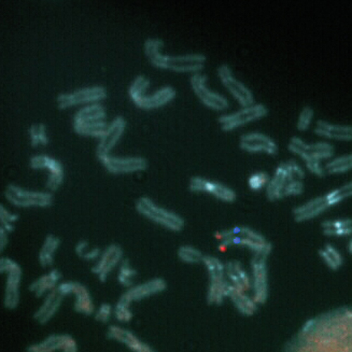 STS (Xp22) / KAL1 (Xp22) / SE X, TC ,10T photo produit