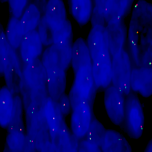 IVD RET (10q11) Break - XL for BOND photo produit Front View S