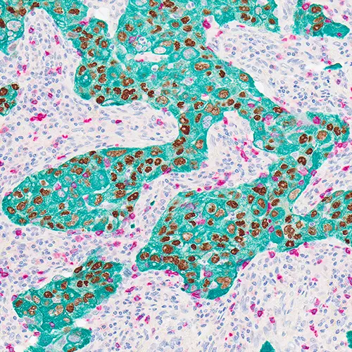 ChromoPlex III Triple Detection RUO photo produit Back View S