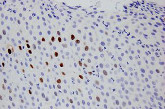 BOND HPV 6/11 Probe photo produit