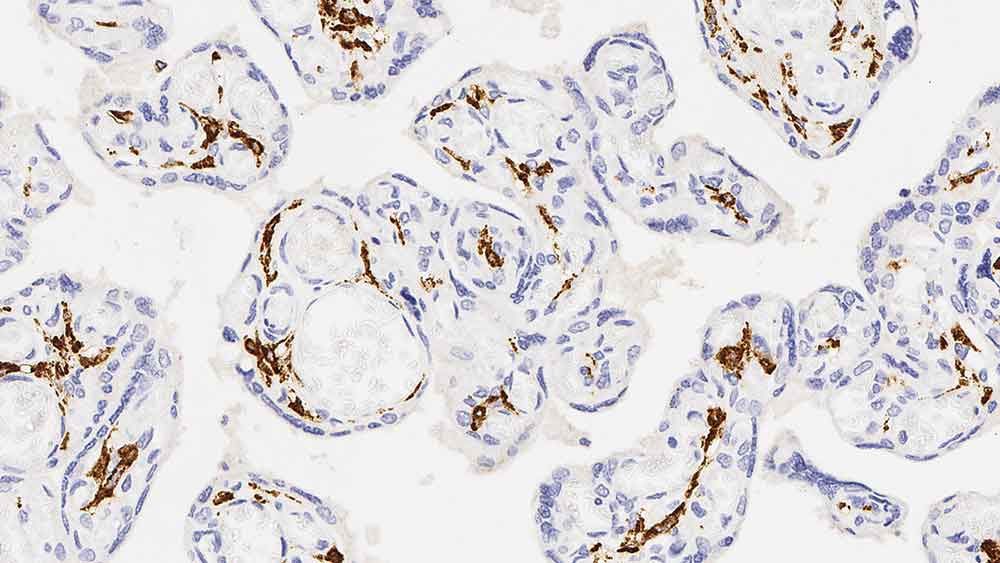 1ml NCL-L-CD163 product photo