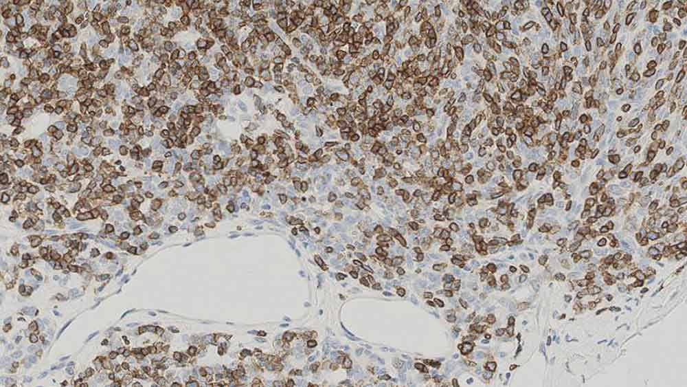 1ml NCL-L-CD1a-235 product photo