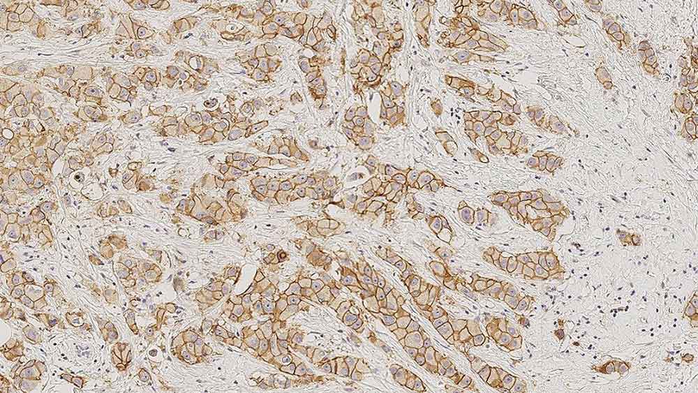 E-Cadherin product photo