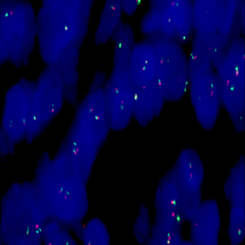 IGH (14q32) Break - XL for BOND product photo