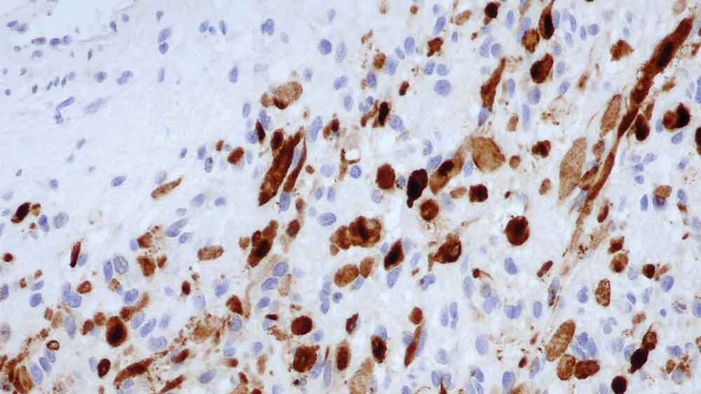 Myoglobin product photo