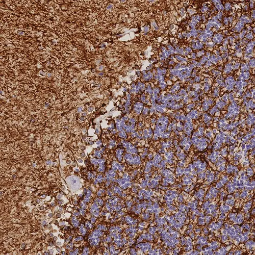 1ml NCL-L-GFAP-GA5 product photo