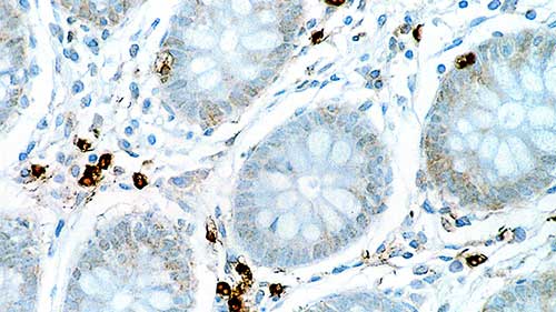 1ml NCL-L-IL6 产品照片